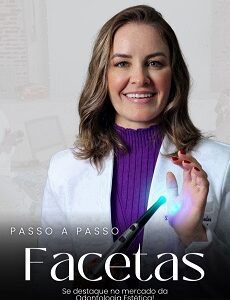 Facetas em Resina Composta