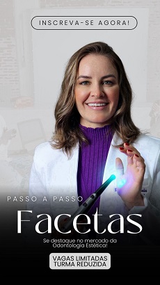 Facetas em Resina Composta